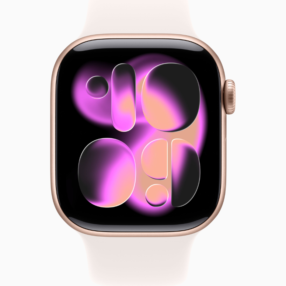 Apple Watch Series 11 - Imagem 5